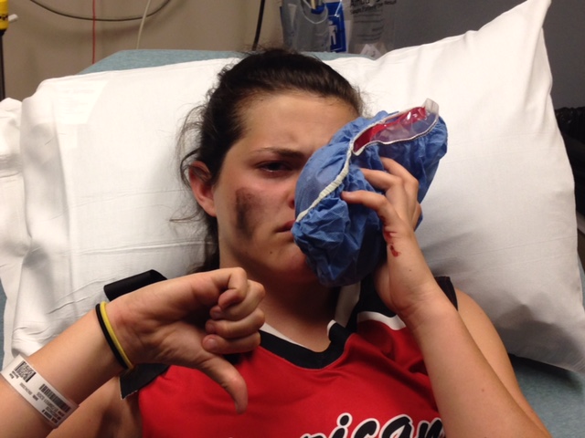 Walsh in the hospital after getting hit in the face with a softball. (Courtesy of Q. Walsh)
